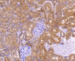 PRMT5 Rabbit anti-Human, Clone: ST51-06, Novus Biologicals 100&mu;L:Antibodies,