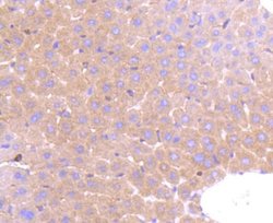 PRMT5 Rabbit anti-Human, Clone: ST51-06, Novus Biologicals 100&mu;L:Antibodies,