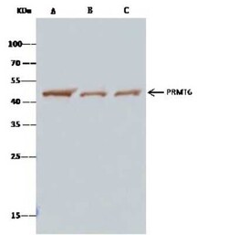 PRMT6 Antibody, Novus Biologicals 50 &mu;g; Unconjugated:Antibodies, Polyclonal