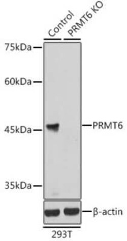 PRMT6 Antibody - Azide and BSA Free, Novus Biologicals 0.1 mL; Unconjugated:Anticuerpos