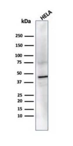 PRMT7 Mouse anti-Human, Clone: PCRP-PRMT7-1A4, Novus Biologicals 20 &mu;g;