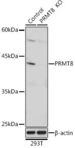 PRMT8 Rabbit anti-Human, Mouse, Rat, Polyclonal, Novus Biologicals 100 &mu;g | Buy Online | Bio-Techne | Fisher Scientific