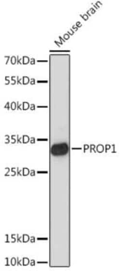 PROP1 Rabbit anti-Mouse, Polyclonal, Novus Biologicals 100 &mu;g; Unconjugated:Antibodies,