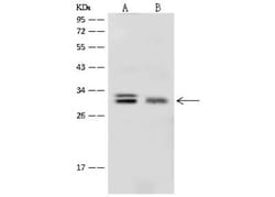 PROSC Antibody, Novus Biologicals:Antibodies:Primary Antibodies