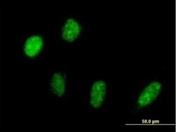 PRP18 Antibody, Novus Biologicals 50 &mu;g | Buy Online | Novus Biologicals | Fisher Scientific