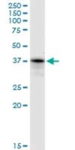 PRP18 Antibody, Novus Biologicals 50 &mu;g | Buy Online | Novus Biologicals | Fisher Scientific