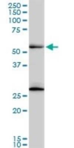 PRP19 Antibody (2E5), Novus Biologicals 0.1 mg | Buy Online | Novus Biologicals | Fisher Scientific