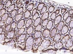 PRP19 Antibody, Novus Biologicals 100 &mu;g, Unconjugated:Antibodies, Polyclonal