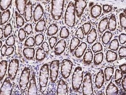 PRP19 Antibody, Novus Biologicals 100 &mu;g, Unconjugated:Antibodies, Polyclonal