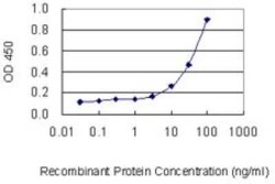 PRPF31 Antibody (8E1), Novus Biologicals 0.1 mg | Buy Online | Novus Biologicals | Fisher Scientific