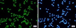 PRPF31 Antibody (S01-7F1), Novus Biologicals:Antibodies:Primary Antibodies