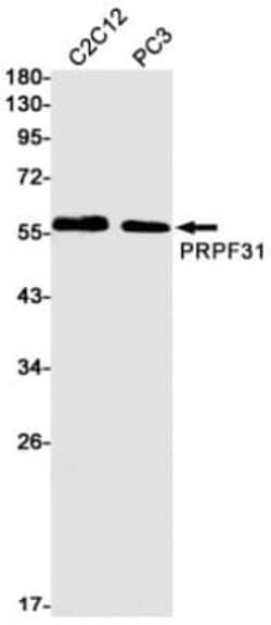 PRPF31 Antibody (S01-7F1), Novus Biologicals:Antibodies:Primary Antibodies