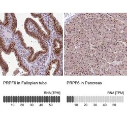 PRPF6 Antibody, Novus Biologicals 25 &mu;L | Buy Online | Novus Biologicals | Fisher Scientific