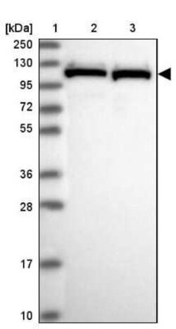 PRPF6 Antibody, Novus Biologicals 25 &mu;L | Buy Online | Novus Biologicals | Fisher Scientific