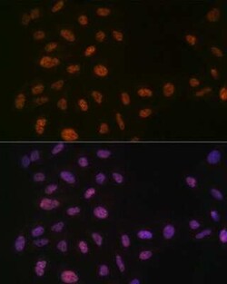 PRPF8 Rabbit anti-Human, Mouse, Rat, Clone: 4I1Q8, Novus Biologicals:Antibodies:Primary