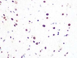 PRPF8 Rabbit anti-Human, Mouse, Rat, Clone: 4I1Q8, Novus Biologicals:Antibodies:Primary