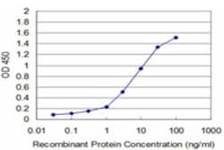 PRPK Antibody (2E10), Novus Biologicals 0.1 mg; Unconjugated:Antibodies,