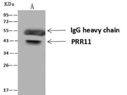 PRR11 Antibody, Novus Biologicals 50 &mu;g; Unconjugated:Antibodies, Polyclonal