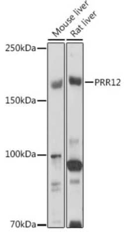 PRR12 Rabbit anti-Human, Mouse, Rat, Polyclonal, Novus Biologicals:Antibodies:Primary