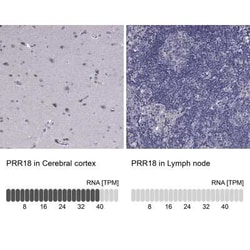 PRR18 Antibody, Novus Biologicals 25 &mu;L | Buy Online | Novus Biologicals | Fisher Scientific