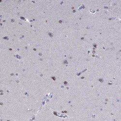 PRR18 Antibody, Novus Biologicals 25 &mu;L | Buy Online | Novus Biologicals | Fisher Scientific