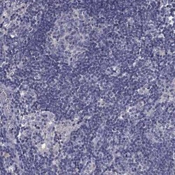 PRR18 Antibody, Novus Biologicals 25 &mu;L | Buy Online | Novus Biologicals | Fisher Scientific