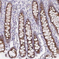 PRR36 Antibody, Novus Biologicals 25 &mu;L, Unconjugated:Antibodies, Polyclonal
