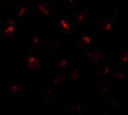 PRR5L Antibody - BSA Free, Novus Biologicals 0.1 mg; Unconjugated:Antibodies,