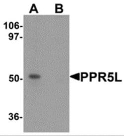 PRR5L Antibody - BSA Free, Novus Biologicals 0.1 mg; Unconjugated:Antibodies,