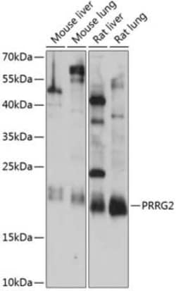 PRRG2 Antibody - Azide and BSA Free, Novus Biologicals 0.1 mL, Unconjugated:Antibodies,