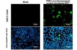 PRRSV Nucleocapsid Antibody, Novus Biologicals 100 &mu;g | Buy Online | Bio-Techne | Fisher Scientific