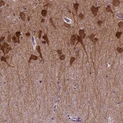 PRRT1 Antibody, Novus Biologicals 25 &mu;L | Buy Online | Novus Biologicals | Fisher Scientific