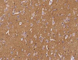 PRRT2 Antibody, Novus Biologicals 100 &mu;g; Unconjugated:Antibodies, Polyclonal