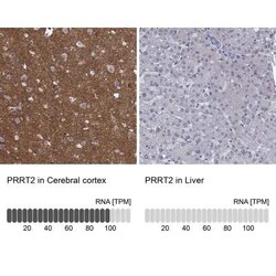 PRRT2 Rabbit anti-Human, Polyclonal, Novus Biologicals 25 &mu;g; Unconjugated:Antibodies,