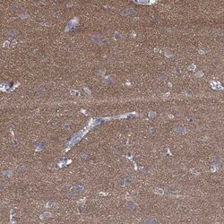 PRRT3 Rabbit anti-Human, Polyclonal, Novus Biologicals 100 &mu;g | Buy Online | Novus Biologicals | Fisher Scientific