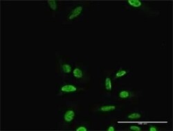 PRRX2 Antibody, Novus Biologicals 0.1 mg | Buy Online | Novus Biologicals | Fisher Scientific