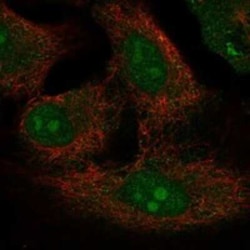 PRY2 Rabbit anti-Human, Polyclonal, Novus Biologicals:Antibodies:Primary