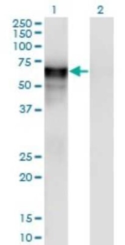 PSAP Antibody (2F6), Novus Biologicals 0.1 mg | Buy Online | Novus Biologicals | Fisher Scientific