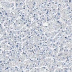 PSD-95 Antibody, Novus Biologicals 25 &mu;L; Unconjugated:Antibodies, Polyclonal