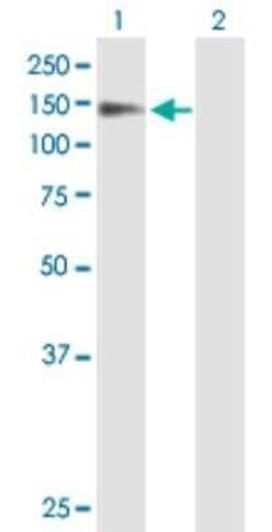 PSD Antibody, Novus Biologicals 50 &mu;g | Buy Online | Novus Biologicals | Fisher Scientific