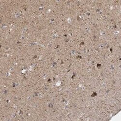 PSD93 Antibody, Novus Biologicals:Anticuerpos:Anticuerpos primarios