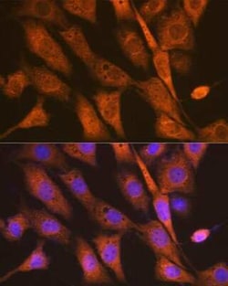 PSENEN/PEN2 Rabbit anti-Human, Mouse, Rat, Clone: 6J5O4, Novus Biologicals 20 &mu;g | Buy Online | Novus Biologicals | Fisher Scientific