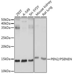 PSENEN/PEN2 Rabbit anti-Human, Mouse, Rat, Clone: 6J5O4, Novus Biologicals 20 &mu;g | Buy Online | Novus Biologicals | Fisher Scientific