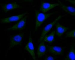 PSENEN/PEN2 Antibody (JE41-28), Novus Biologicals 100 &mu;l; Unconjugated:Antibodies,