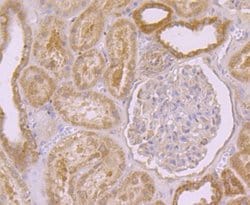 PSENEN/PEN2 Antibody (JE41-28), Novus Biologicals 100 &mu;l; Unconjugated:Antibodies,