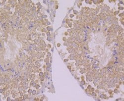 PSENEN/PEN2 Antibody (JE41-28), Novus Biologicals 100 &mu;l; Unconjugated:Antibodies,