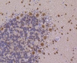 PSENEN/PEN2 Antibody (JE41-28), Novus Biologicals 100 &mu;l; Unconjugated:Antibodies,