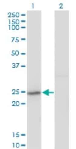 Novus Biologicals PSF2 Antibody (3H4), Novus Biologicals 0.1 mg, Unconjugated:Antikörper