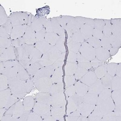 PSGL-1/CD162 Rabbit anti-Human, Polyclonal, Novus Biologicals 25 &mu;g;