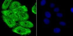 PSMA1 Rabbit anti-Human, Mouse, Rat, Clone: JU66-24, Novus Biologicals